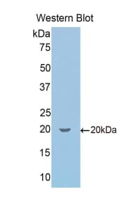 SCG2 / Secretogranin II Antibody (aa430-586)