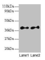 IHC-plus™ SCAMP3 Antibody (aa2-170)