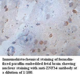 Polyclonal Rabbit anti-Human ZNF34 Antibody (aa94-361, IHC, WB)
