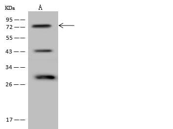 Polyclonal Rabbit anti-Human FIGNL1 Antibody (IHC, WB)