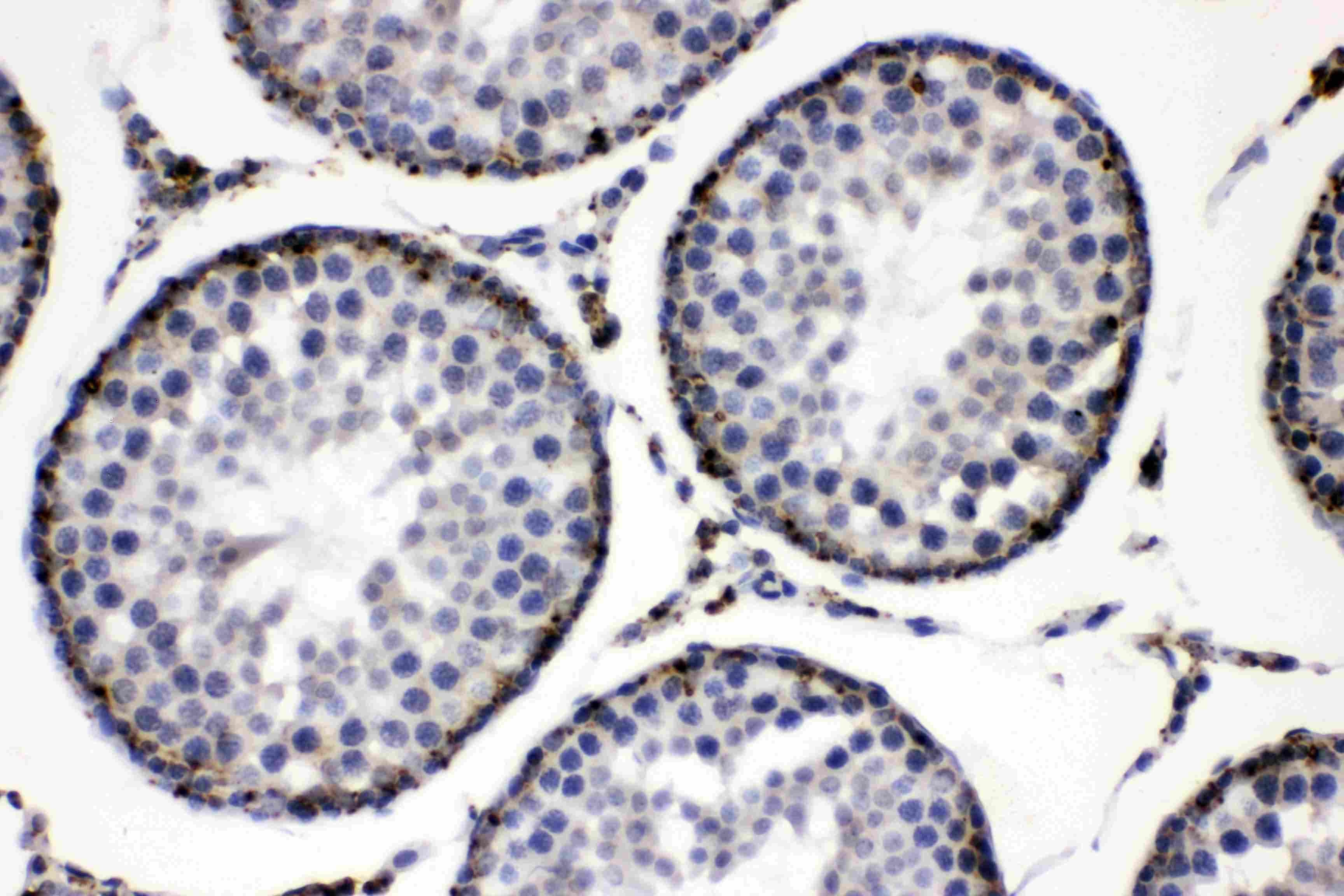 PLIN2 / ADFP / Adipophilin Antibody