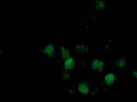 DSTN / Destrin Antibody (clone OTI2E10, Carrier-free)