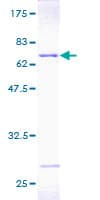 Human PSMD7 / MOV34 Protein (Recombinant GST)