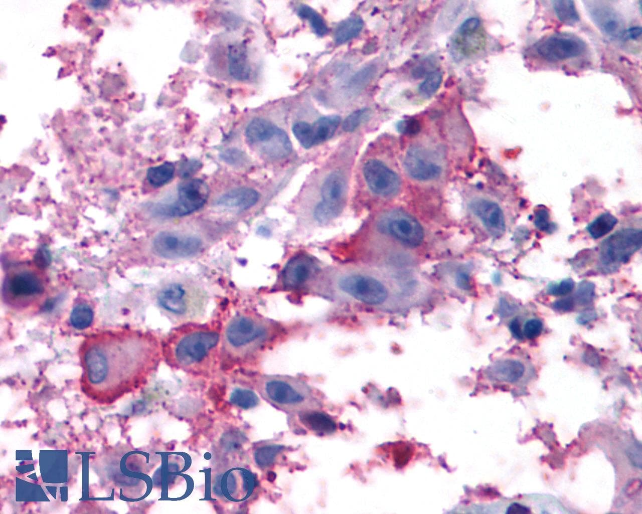 PathPlus™ Polyclonal Rabbit anti-Human GRM7 / MGLUR7 Antibody (N-Terminus, IHC, WB)