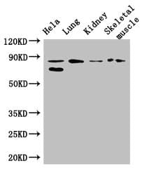 Polyclonal Rabbit anti-Human PRDM4 Antibody