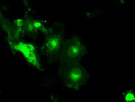 SLC2A5 / GLUT5 Antibody (clone OTI14C8)