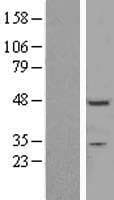 ZNF558 Protein (Over-Expression Lysate Myc-DDK (Flag))