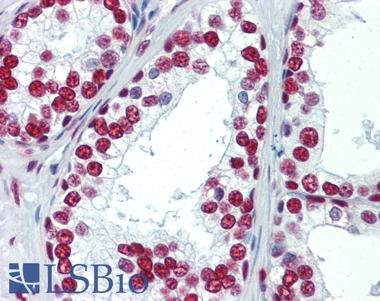 IHC-plus™ SAE1 Antibody (clone 1G8)