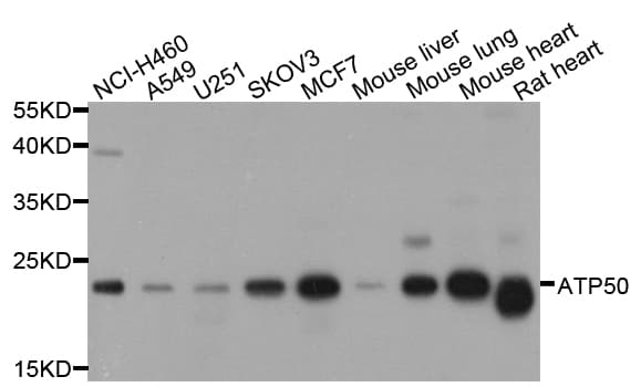 ATP5O Antibody