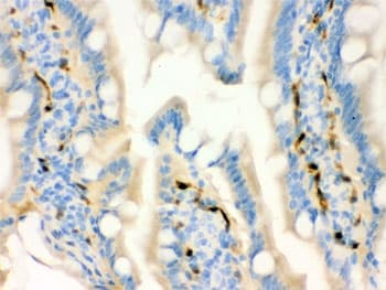 Polyclonal Rabbit anti-Human FABP4 / AP2 Antibody (IHC, WB)