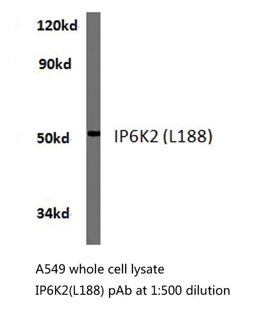 Polyclonal Rabbit anti-Human IP6K2 Antibody (Leu188, IHC, IF, WB)