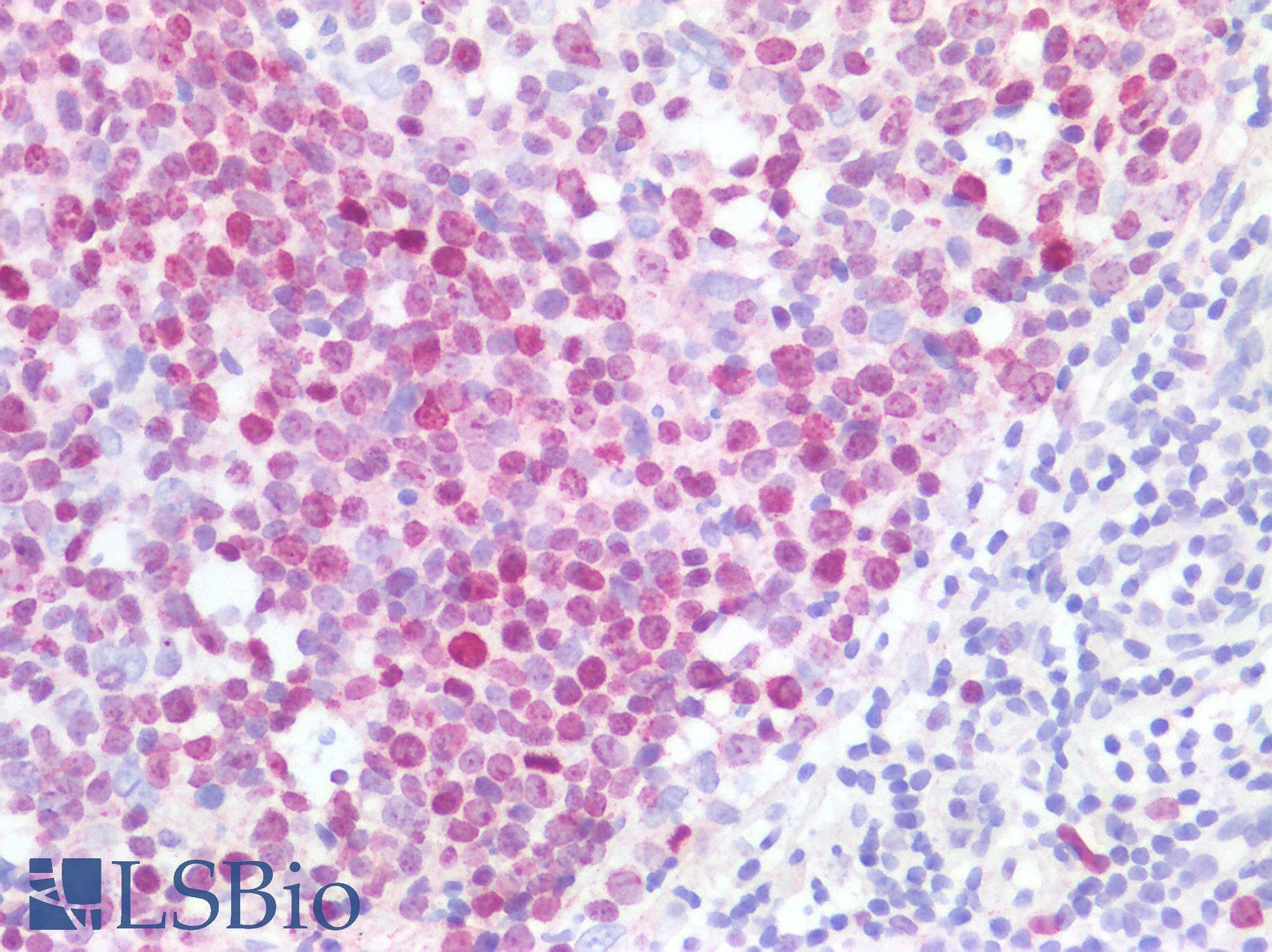 PathPlus™ MKI67 / Ki67 Antibody (clone 19, Preservative Free)