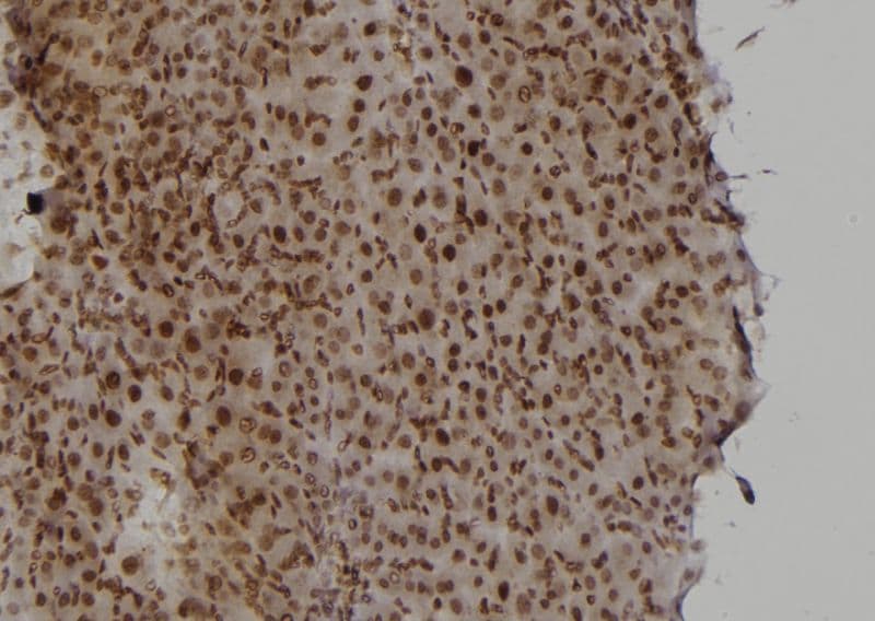 Polyclonal Rabbit anti-Human RAD52 Antibody (IHC, IF, WB)