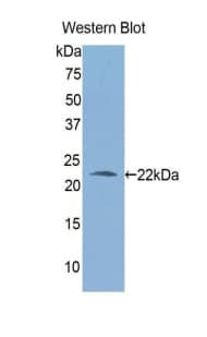ALDH1A3 Antibody (aa332-509)