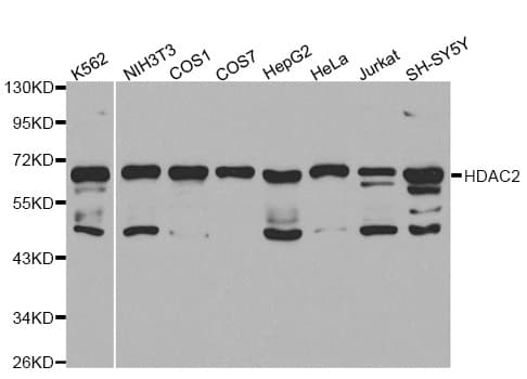 Polyclonal Rabbit anti-Human HDAC2 Antibody (IHC, IF, WB)
