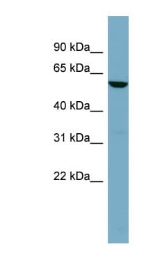 Polyclonal Rabbit anti-Human Alpha Fucosidase / FUCA1 Antibody (aa143-192, WB)