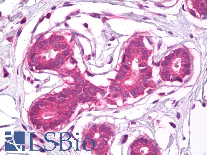 IHC-plus™ Polyclonal Rabbit anti-Human CD44 Antibody (IHC, WB)