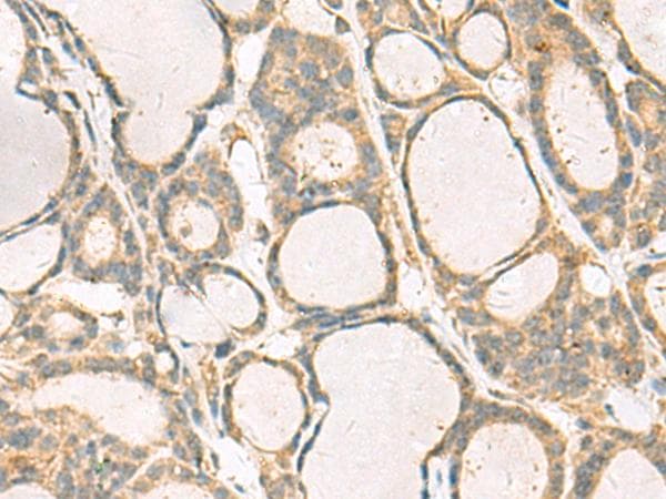 KIF2C / MCAK Antibody