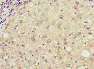 Polyclonal Rabbit anti-Human TCL / RHOJ Antibody (IHC)