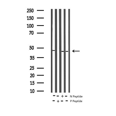 MAP2K2 / MKK2 / MEK2 Antibody (phospho-Thr394)