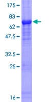Human FBXO31 Protein (Recombinant GST)