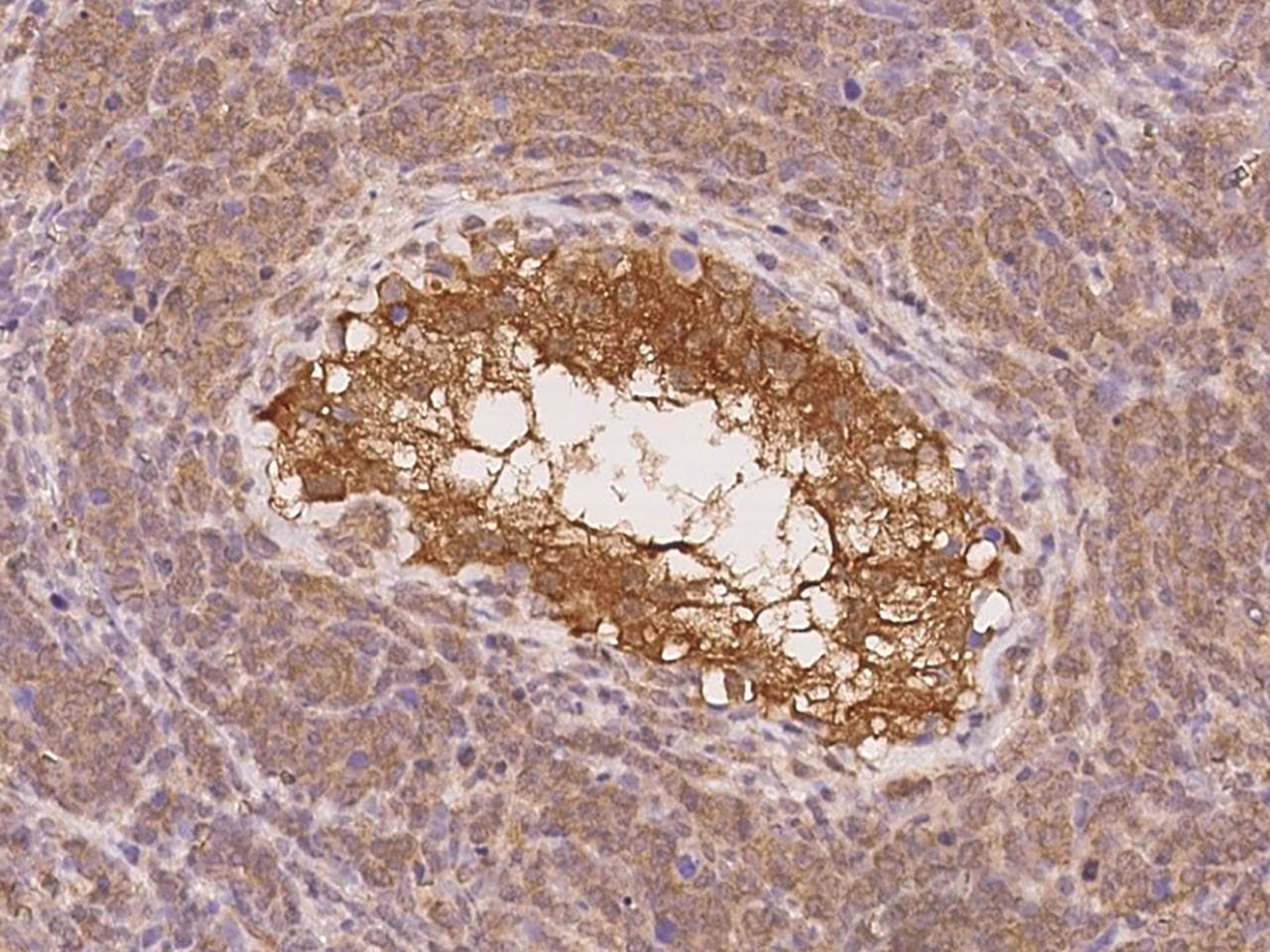SOWAHD / ANKRD58 Antibody