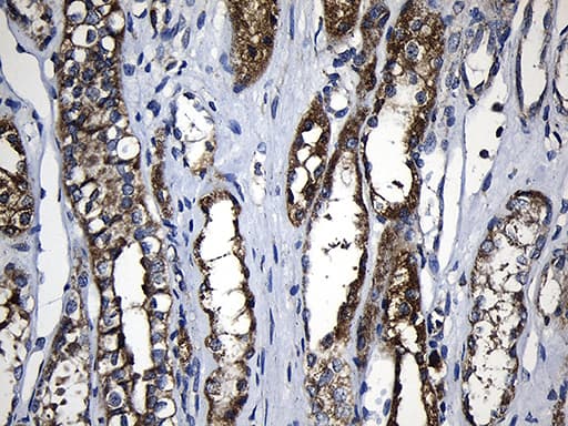 PCCA Antibody (clone OTI1E9)