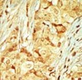 MOK / RAGE Antibody (aa377-407)