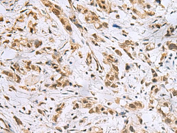 NABP1 / OBFC2A Antibody