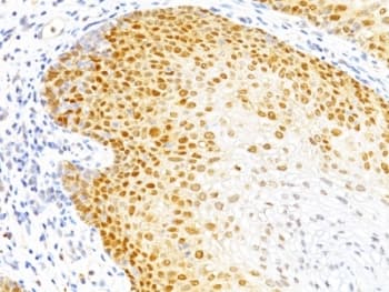 CDKN1B / p27 Kip1 Antibody (clone DCS-72.F6)