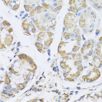 PRKAG1 / AMPK Gamma 1 Antibody