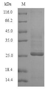Human KCND1 / Kv4.1 Protein (Recombinant 6His, N-terminus)