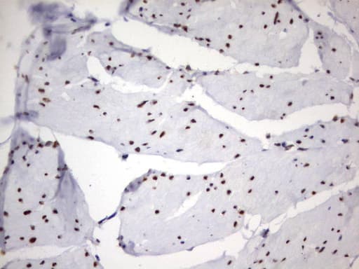 PARN Antibody (aa1-266, clone UMAB143)