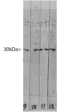 IHC-plus™ LGALS3 / Galectin 3 Antibody (clone 52C1)