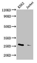 Polyclonal Rabbit anti-Human MOB1A Antibody (aa2-216, IHC, WB)