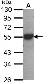 Polyclonal Rabbit anti-Human CYP2D6 Antibody (IHC, WB)