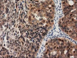 PYCRL Antibody (clone OTI3B9)