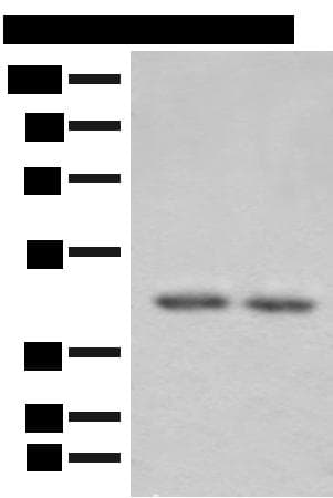 Polyclonal Rabbit anti-Human ILKAP Antibody (IHC, WB)