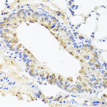 Osteocalcin Antibody (AP)