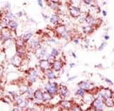 Polyclonal Rabbit anti-Human USP4 Antibody (aa903-933, IHC, WB)