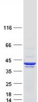 Human MAPRE2 / EB2 Protein (Recombinant Myc-DDK (Flag))