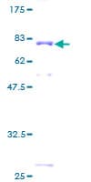 Human SSB / La Protein (Recombinant GST)