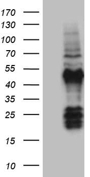 Monoclonal Mouse anti-Human FAM131C Antibody (clone OTI1C2, IHC, WB)