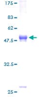 Human TREM2 / TREM-2 Protein (Recombinant GST)