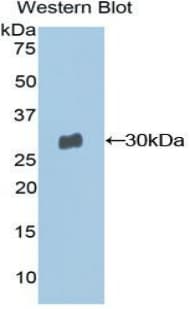 MSN / Moesin Antibody (aa354-577)