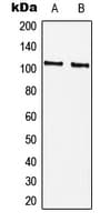 RBBP8 / CTIP Antibody (phospho-Ser327)
