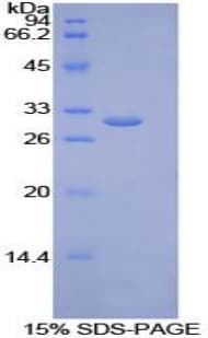 Human LIPG / Endothelial Lipase Protein (Recombinant His-T7)