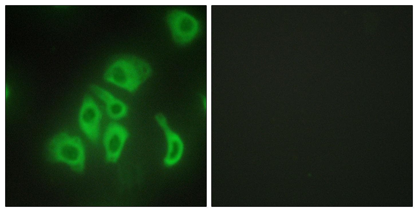TNF Alpha Antibody
