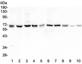 HAS1 / HAS Antibody