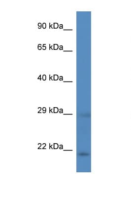 DHAND / HAND2 Antibody (C-Terminus)
